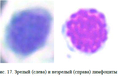 Рис. 17. Зрелый (слева) и незрелый (справа) лимфоциты